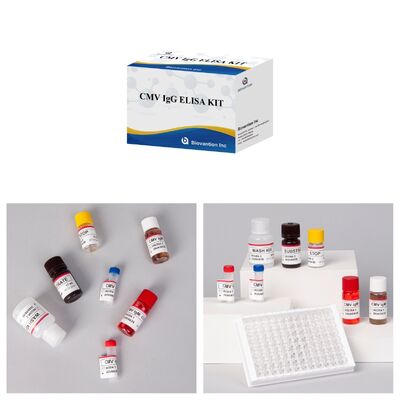 96T CMV ELISA Test Kit mit kolorimetrischer Detektion und Sandwich-Methode für Zytomegalievirus-Antikörper