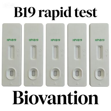 One Step Colloidal Gold Rapid Test For IgM Antibody To Human Parvovirus B19