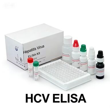 Anti-HCV-Antikörper gegen das Hepatitis-C-Virus Enzymgebundene Transportzeit kurz