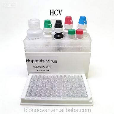 Anti-HCV-Antikörper gegen das Hepatitis-C-Virus Enzymgebundene Transportzeit kurz