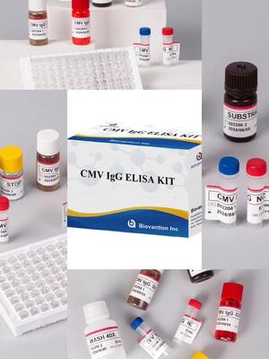 Im Labor oder im Krankenhaus eingesetztes hochgenaues CMV-IgG-Elisa-Testgerät