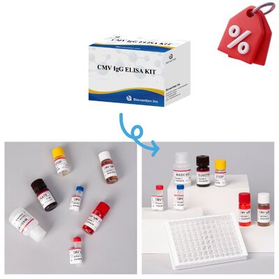 Enzym-Immunreagenzien Elisa-Test-Kit zur Detektion von CMV-Antikörpern gegen Zytomegalovirus
